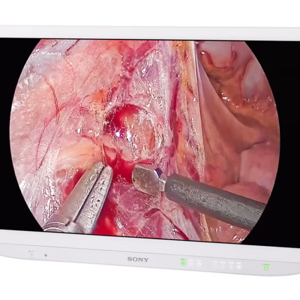 sony lmd 43mimd medical 4k 43 inch monitor