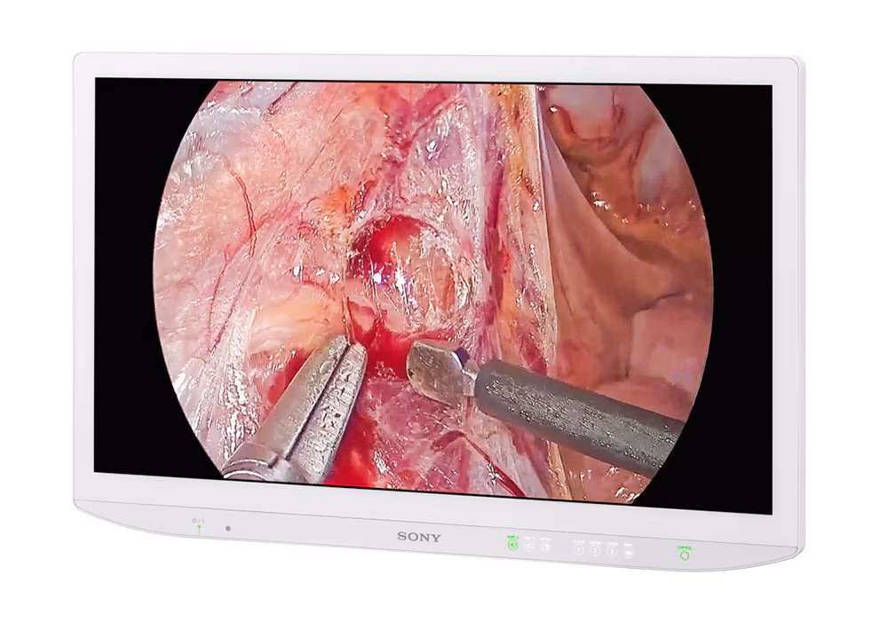 sony lmd 43mimd medical 4k 43 inch monitor